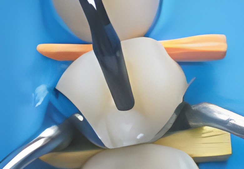 Клинический случай 1